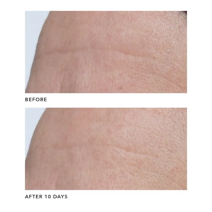 Sleeping Collagen